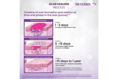 Mederma Advanced Plus Scar Gel